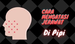 jerawat di pipi