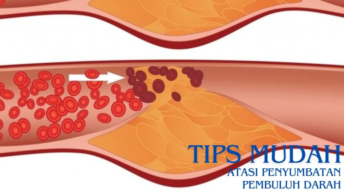 Tips Mudah Atasi Penyumbatan Pembuluh Darah!